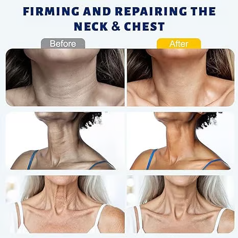 YDWIG™ 5-Roller Neck Firming Cream – Collagen & Hyaluronic Acid for Smoother, Tighter-Looking Neck Skin