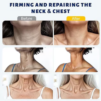 YDWIG™ 5-Roller Neck Firming Cream – Collagen & Hyaluronic Acid for Smoother, Tighter-Looking Neck Skin