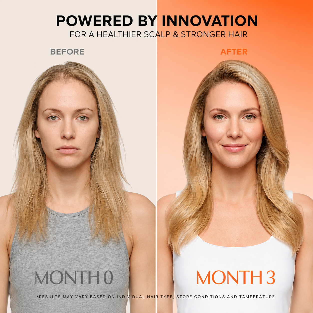 Exosome Scalp Care Serum with Built-In Massage Brush for Fuller-Looking Hair